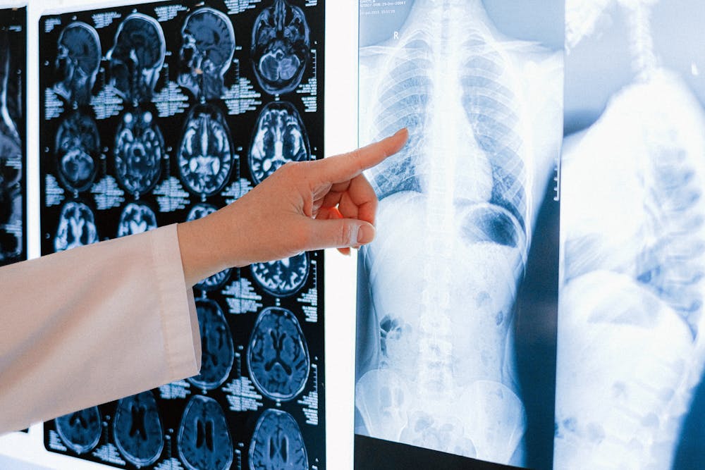 Radiología - imagen ilustrativa de IA en salud